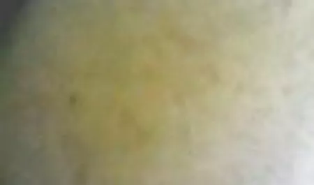 مهار نکردن شروع به تکان دادن و مکیدن در دست ماساژ درمانی فیلم سینمایی بدون سانسور سکسی